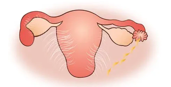 Alarelin Adjuvant Postoperative Therapy | Shaanxi BLOOM Tech Co., Ltd Alarelin Adjuvant Postoperative Therapy | Shaanxi BLOOM Tech Co., Ltd