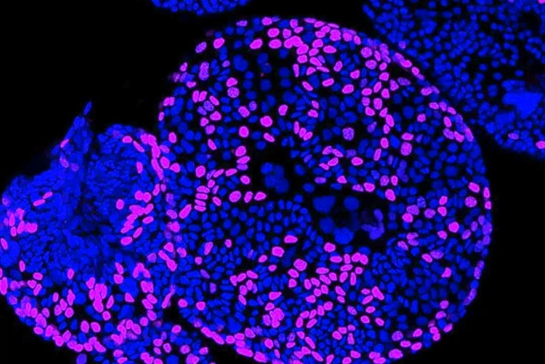 Alarelin Efficacy Evaluation | Shaanxi BLOOM Tech Co., Ltd Alarelin Efficacy Evaluation | Shaanxi BLOOM Tech Co., Ltd